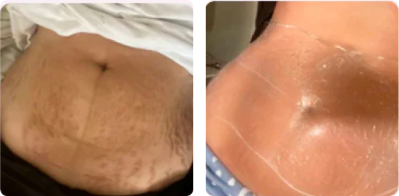 <h4><strong>Disminuye la apariencia de la celulitis</strong></h4>