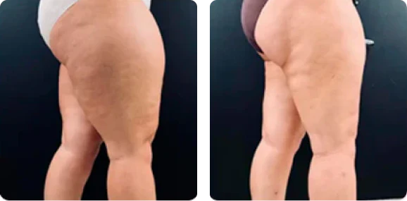 <h4><strong>Modela y reduce medidas</strong></h4>