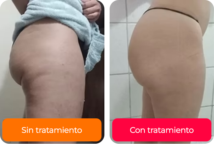 <h4><strong>Modela y reduce medidas</strong></h4>